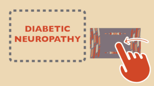 Diabetic Neuropathy Interactive Thumbnail - Native Reach